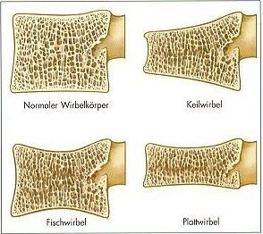 wirbel2.jpg